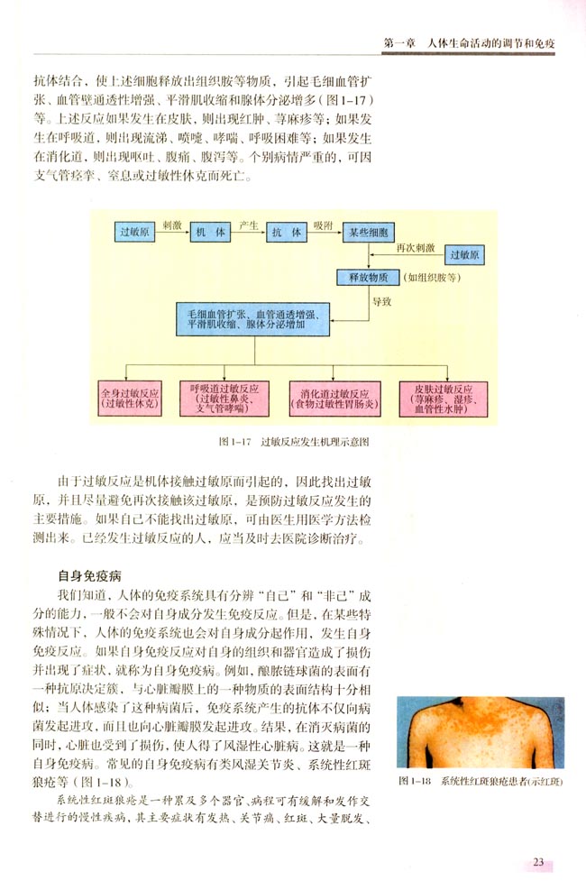 二 免疫失调引起的疾病(第23页)